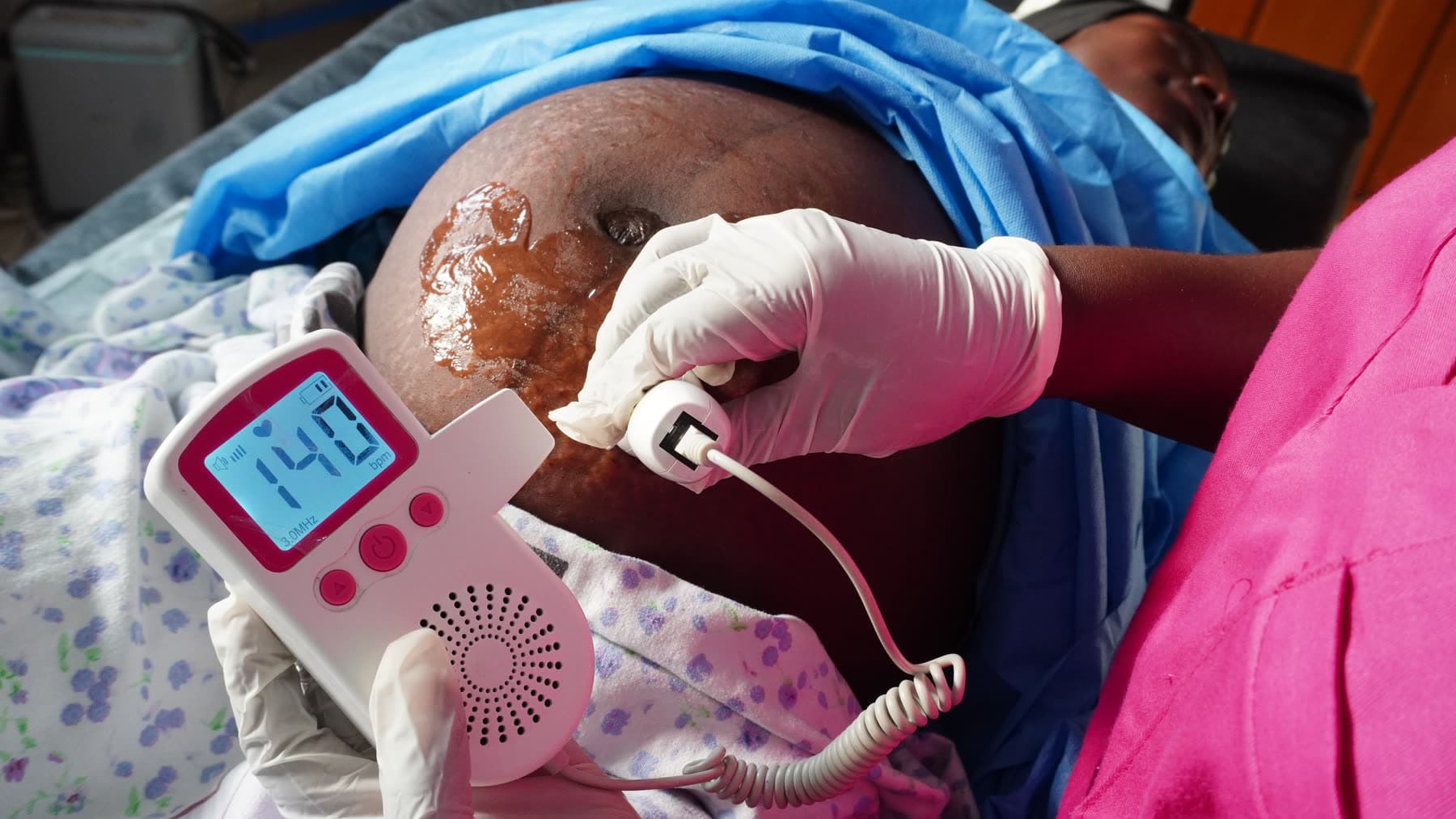 Placeholder for Fetal monitoring
